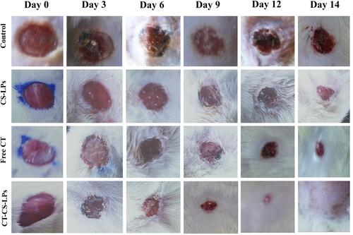 Figure 5 Photographs of wound healing were taken on the 0th, 3rd, 6th, 9th, 12th, and 14th days in different diabetic rats in; control (untreated), chitosan-coated liposomes without citicoline (CS-LPs), free citicoline (free CT), and optimized citicoline chitosan-coated liposomes (CT-CS-LPs) groups.