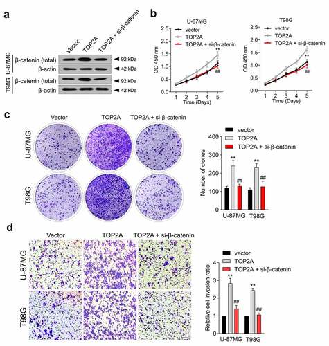 Figure 4. β-catenin mediates the function of TOP2A to promote the proliferation and invasion of glioma cell. (a) U-87 MG and T98G cells were transfected with TOP2A or cotransfected with TOP2A and si-β-catenin. The expression of β-catenin was measured using immunoblotting. (b) The growth curves of indicated cells were detected by CCK-8 assay. (c) The colonizing abilities were detected by colony formation assays when β-catenin was knocked down in cells transduced with TOP2A. (d) The invasion abilities were assessed by transwell assays when β-catenin was knocked down in cells transduced with TOP2A plasmid. Data were determined from triplicate experiments (Mean ± SD). **P < 0.01 compared with vector, ##P < 0.01 compared with TOP2A.