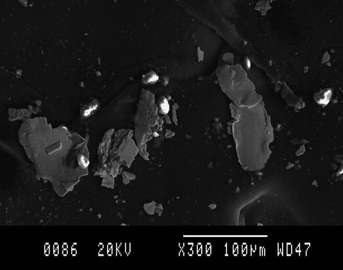 Figure 2. Platelet wear particles, 300× magnification.