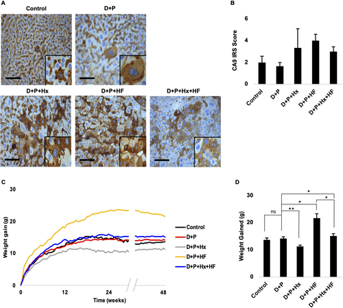 Figure 1 Male Balb/C mice were exposed to diethylnitrosamine and phenobarbital (D+P), or additionally exposed to hypoxia (D+P+Hx), given a high-fat diet (D+P+HF), or both hypoxia and a high-fat diet (D+P+Hx+HF) for 48 weeks. Control animals were left untreated. Weights of the animals were determined twice weekly. (A) Liver sections from control and treatment mice were immunostained with an anti-carbonic anhydrase antibody (CA9). (B) The extent of the staining in panel A was determined by the average immunoreactivity scoring (IRS) score for each of the groups. Each bar represents the mean ± s.e. Scale bar; 100 µm. (C) The average weight of the animals for control and each of the treatment groups over 48 weeks is shown. (D) Average weight gained at 48 weeks. Asterisks indicate a significant difference between the indicated group and D+P (*p ≤ 0.05, **p ≤ 0.01). N ≥ 4 mice per group.