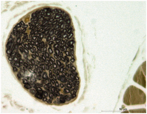 Figure 3. Sectional diagram of tibialis anterior nerve branch after osmium stain. (×400; number of nerve fibres: 248).