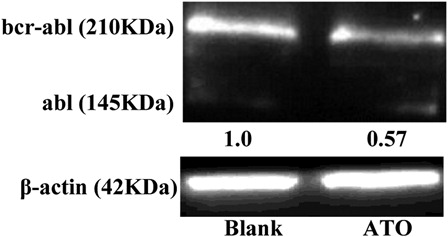 Figure 6. ATO downregulated bcr-abl protein level by western blot. K562 cells were treated with ATO (2.0 µM) for 48 hours, and the bcr-abl protein level was determined by western blot. The data represents the mean value of three independent experiments. ATO significantly reduced bcr-abl protein levels in CML cell. *P < 0.01, compared with blank controls.