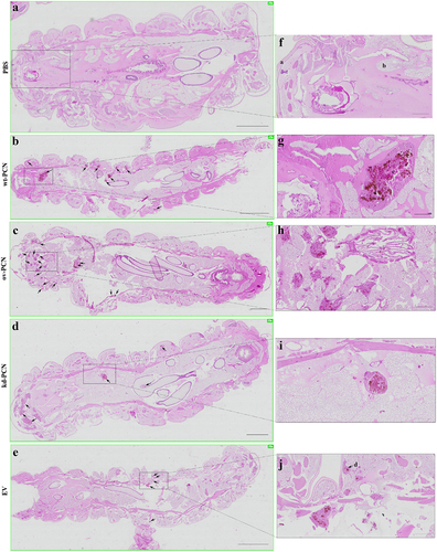 Figure 4. PCN effect on the virulence of P. brasiliensis according to histological findings in infected G. mellonella larvae. Forty-eight hours after being infected with yeasts from P. brasiliensis strains, wt-PCN (b), ov-PCN (c), kd-PCN (d), and EV (e), G. mellonella larvae sections were PAS-stained and microscopically examined. Control corresponds to uninfected larvae inoculated with phosphate-buffered saline (PBS) instead of yeasts (a). 20X amplification (a-e). Enlarged images (f-j). Bars indicate 1 mm at A, C, and D; 2 mm in B and E; and 200 µm of F-J. Black arrows indicate P. brasiliensis yeast aggregates; a, cuticle; b, adipose bodies; c, granuloma-like structure; d, fungal cells.