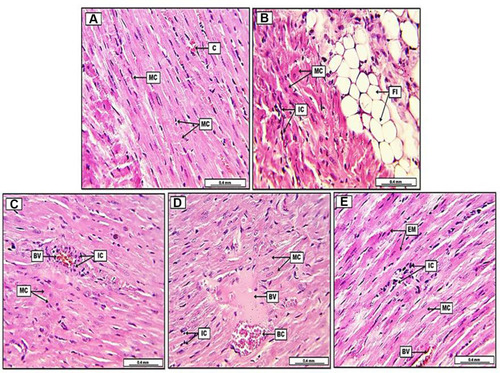 Figure 4 Photomicrograph of heart from groups; (A) control group, display typically arranged myocardial cells (MC), with their oval nuclei and light pinkish cytoplasm, in addition, the section shows some congested blood capillaries (C). (B) Doxorubicin group (DOX), reveal remarkable fatty infiltration (FI) within the cardiac muscle, together with significant fatty degeneration (FD), the section shows severe degenerative changes in myocardial muscle (MC), together with the infiltration of inflammatory cells (IC). (C) Doxorubicin, quercetin and sitagliptin group (DOX+QC+STN), display slight pre-vascular cuffing of inflammatory cells (IC), together with vascular congestion in some blood vessels (BV), moreover, some myocardial cells (MC) show acidophilic cytoplasm with condensate nuclei. (D) Doxorubicin and quercetin group (DOX+GC), demonstrate slight to moderate infiltration of inflammatory cells (IC), the section reveals some blood vessels (BV) with semi-coagulated red blood cells (BC) and eosinophilic plasma-rich protein. Myocardial muscle (MC) shows oval nuclei with cross-striated appearance. (E) Doxorubicin and sitagliptin group (DOX+STN), reveal slight infiltration of inflammatory cells (IC), the section shows some eosinophilic myocardial muscle cells (EM) with condensate nuclei, however, some other myocardial cells (MC) demonstrate typical cross striation together with their oval nuclei. Some blood vessels appear congested (BV). H&E. Scale bars: 0.4 mm.