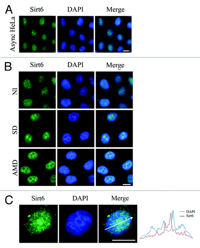 Figure 2. Sub-nuclear localization of endogenous Sirt6. (A) Asynchronous HeLa cells stained with anti-Sirt6 (M) show both nucleoplasmic and nucleolar staining. (B) Compared with cells cultured under normal conditions, serum deprivation causes the nucleolar Sirt6 signal to increase, while actinomycin D treatment causes nucleolar Sirt6 to be released into the nucleoplasm. (C) Sirt6 does not co-localize with intense DAPI staining, especially in the perinucleolar region. AMD, actinomycin D; NL, normal; SD, serum deprivation. Scale bars, 10 µm.