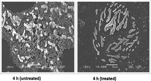 Figure 3 Scanning electron microscopy (SEM) images showing untreated and levofloxacin treated 4 hours E. coli biofilm cells. Concentrations of levofloxacin was 50 μg/mL. Magnification: ×4000.