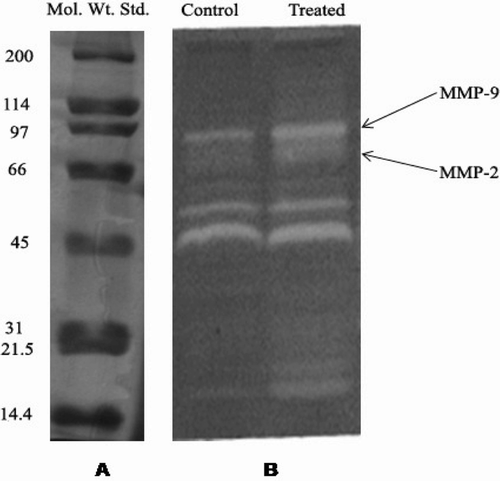 Figure 1.  (A) Expression of standard marker proteins (Broad Range, BIO RAD, 10% SDS-PAGE) and (B) Matrix metalloproteinase expression by gelatin zymography (10% SDS-PAGE, 1 g/L gelatin) in methanol leaf extract of A. aspera (MEAA)-treated and untreated burn wound tissue of experimental rats after 7 days of treatment.