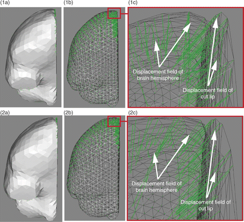 Figure 6. Comparison of unsmoothed (row 1) and jointly smoothed (row 2) displacement fields of right hemisphere and right lip of the cut. (1a) Surface meshes of right hemisphere and right lip of cut, and their surface displacement fields in green. (1b) Same as (1a), except that the surface meshes are left transparent. (1c) Zoom of (1b) around the external surface of the brain. (2a), (2b) and (2c) are, respectively, the same as (1a), (1b) and (1c), except that the displacement fields are jointly smoothed. (In each sub-figure, the direction of the displacement vectors is defined such that the vectors start at the surface mesh nodes.)