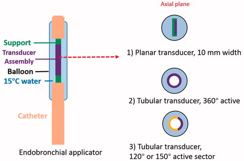 Figure 2. Design schema of endobronchial ultrasound applicators for thermal treatment of lung tumors adjacent to major bronchi and deep lung. Ultrasound transducer applicator configurations include (1) planar transducer, (2) fully active (360°) tubular transducer, and (3) angular sectored (120° or 150° active sector) tubular transducer, each integrated within an expandable balloon for coupling and water cooling.