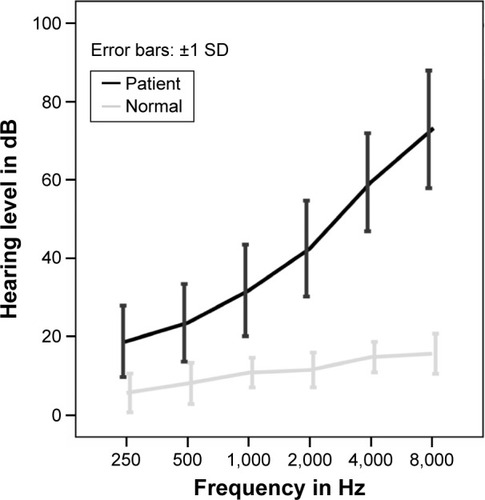 Figure 2 Mean audiograms of patients with presbycusis and healthy subjects. Error bars represent SDs.