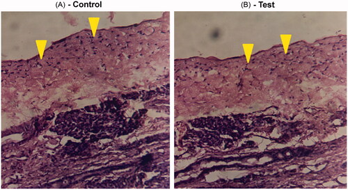 Figure 3. Light photomicrograph of anterior cross-section of rat nasal cavity following fourteen day exposure to intranasal TM gel. (A) Photomicrograph from left nostril (control) of the rat that was not dosed. (B) Photomicrograph from right nostril of the same rat which was dosed with intranasal gel. Arrows show intact epithelium in both the cases.