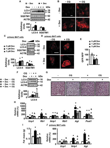 Figure 2. Dex stimulates autophagy and Dex-induced BAT whitening is prevented by blockade of autophagy in vivo and in vitro. (A) LC3-II and SQSTM1 protein levels were analyzed in the BAT of male WT mice i.p. injected with Dex (+ Dex) or PBS (- Dex) for 1 week. (B) Confocal micrographs of BAT from male WT mice i.p. injected with Dex (+ Dex) or PBS (- Dex) for 1 week, with CQ (+ CQ) or PBS (- CQ) for 1 day. (C) LC3-II and SQSTM1 protein levels were analyzed in primary cultured brown adipocytes treated with 0, 1 or 5 μM Dex for 24 h. (D) Confocal micrographs of primary cultured brown adipocytes treated with Dex (+ Dex) or PBS (- Dex), with CQ (+ CQ) or PBS (- CQ) for 24 h. (E) Autophagic flux was measured in primary cultured brown adipocytes expressing GFP-LC3-RFP-LC3△G cultured with 0, 1 or 5 μM Dex for 24 h. (F-I) BAT LC3-II protein levels (F), H&E staining of BAT (G), mRNA levels of brown adipocyte markers and white adipocyte markers in BAT (H), body fat mass (I) were analyzed in male WT mice i.p. injected with CQ (+ CQ) or PBS (- CQ) for 1 week, prior to being treated with Dex (+ Dex) or PBS (- Dex) for 1 week. (J) mRNA levels of brown adipocyte markers and white adipocyte markers in primary cultured brown adipocytes treated with Dex (+ Dex) or PBS (- Dex), with CQ (+ CQ) or PBS (- CQ) for 24 h. Scale bars: 20 μm in B and D, 200 μm in G. Data are represented as mean ± SEM. Statistical significance was calculated using the two-tailed Student t-test for the effects of with compared to without Dex (*: p < 0.05) in A, C and E, or one-way ANOVA followed by the Student-Newman-Keuls (SNK) test for the effects of any group versus the control group (*: p < 0.05), with versus without Dex in CQ group (#: p < 0.05), with versus without CQ in Dex group (&: p < 0.05) in F,H-J.