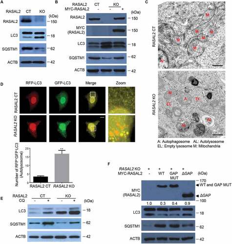 Figure 1. Silencing RASAL2 initiates basal autophagy. (A, B, E) Autophagy assays were measured in RASAL2-CT or RASAL2-KO MCF7 cells. (A) Immunoblotting detection of autophagy-related proteins in these cells, (B) transfected with or without MYC-RASAL2, or (E) in the presence or absence of 50 μM chloroquine (CQ) for 4 h. (C) TEM analysis of autophagosomes and autolysosomes (scale bars: 0.5 μm). (D) GFP-RFP-LC3 plasmids were transfected in these cells and monitored using a fluorescence microscope. White boxed regions in the panels are enlarged. Scale bars: 10 μm. Representative images of RFP-positive and GFP-negative LC3-labeled autolysosomes are shown. Data represent the mean ± SEM, n = 50, **p < 0.01). (F) RASAL2-KO MCF7 cells transfected with MYC-RASAL2 (WT), GAP activity–deficient mutant (MYC-RASAL2-GAP-mut), or GAP domain deletion mutant (MYC-RASAL2-ΔGAP) were used for immunoblotting analyses with indicated antibodies. The relative amount of LC3-II was semi-quantified by grayscale analysis