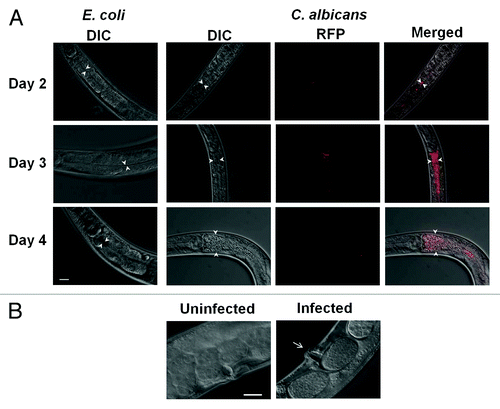 Figure 2. Different phenotypes are observed due to Candida infection. (A) Exposure to C. albicans causes intestinal distention in the worms over time (Days 2, 3 and 4). DIC (Nomarski) pictures of worms feeding on E. coli was taken as control and the DIC, RFP and merged pictures of worms infected with C. albicans are shown over 3 d. (B) Vulva swelling is observed (arrow points to the vulvar region) by Day 4 when worms are exposed to Candida compared with worms exposed E. coli as control (uninfected). Scale = 20 µm.