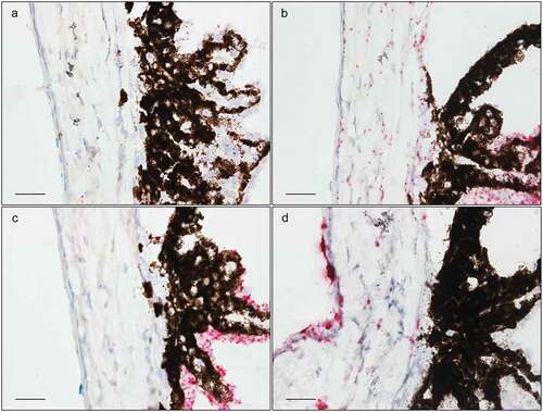 Figure 7. In situ hybridization staining (red dots) of Tnf (a), Tgfβr3 (b), F5 (c), and Dusp1 (d) transcripts in the trabecular meshwork and at the iridocorneal angle. Scale bar: 25 µm.