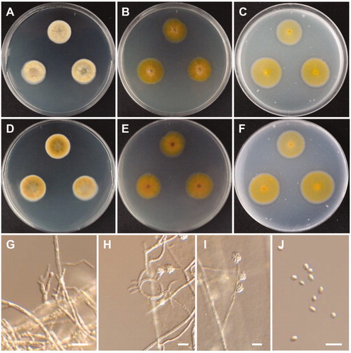Figure 8. Morphology of Cadophora novi-eboraci CNUFC MSW11-6-2. (A,D) Colonies on potato dextrose agar. (B,E) Colonies on malt extract agar. (C,F) Colonies on oatmeal agar. (A–C) obverse view, (D–F) reverse view. (G–I) Conidiogenous cells and conidia in slimy heads. (J) Conidia. Scale bars: G-J = 10 µm.