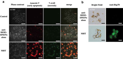 Figure 5. Immuno-MHT induces apoptosis of HER2-expressing AU565 cells, indicated by an anti-Hsp70 antibody