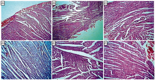 Figure 4. Effect of l-arginine on alteration in heart histology in EG-induced urolithiasis in uninephrectomized rats. Photomicrograph of sections of heart of normal (A), urolithiasis control rats (B), Telmisartan (10 mg/kg) treated rats (C), Cystone (500 mg/kg) treated rats (D), l-arginine (500 mg/kg treated rats (E), and l-arginine (1000 mg/kg) treated rats (F). H & E staining at 100×.