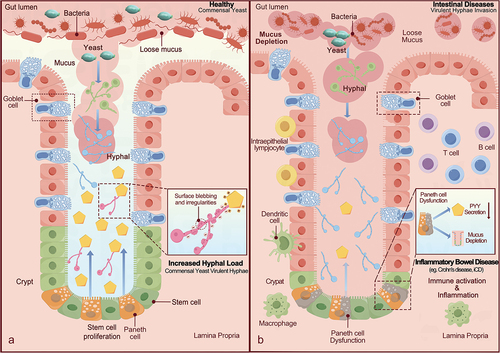 Figure 1. Mechanism of PYY release from paneth cells (PCs), its regulation by fungal symbionts, and their potential implications in inflammatory bowel disease.