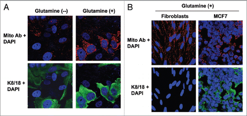 Figure 1 Glutamine increases the mitochondrial mass of MCF7 cells cocultured with fibroblasts. (A) Fibroblast-MCF7 cell cocultures were maintained in media containing high glutamine (right) or no glutamine (left) for 5 d. Cells were then fixed and immuno-stained with antibodies directed against the intact mitochondrial membrane (red) and K8/18 (green). Nuclei were counterstained with DAPI (blue). The upper panels show the mitochondrial staining (red channel). The bottom panels show the K8/18 staining (green channel) to identify the MCF7 cell population. Note that high glutamine increases the mitochondrial mass specifically in MCF7 cells as compared with cocultures maintained without glutamine. However, glutamine does not promote mitochondrial biogenesis in the fibroblasts. Original magnification, 40x. (B) Fibroblasts and MCF7 cells were maintained as single cell-type cultures in high glutamine media for 5 d. Cells were fixed and immunostained with antibodies directed against the intact mitochondrial membrane (red) and K8/18 (green). Nuclei were counter-stained with DAPI (blue). The upper panels show the mitochondrial staining (red). The bottom panels show K8/18 staining (green) labeling MCF7 cells. Note that when cultured as single cell-types in high glutamine conditions, the mitochondrial mass is slightly higher in fibroblasts than in MCF7 cells. Original magnification, 40×.