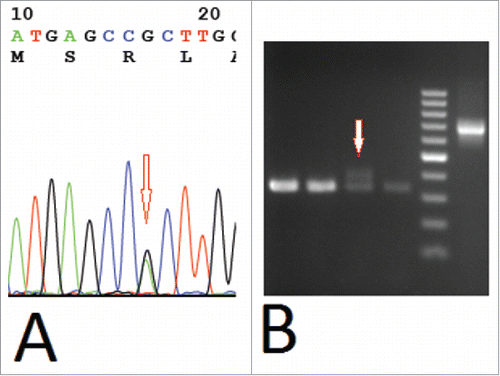 Figure 3. Molecular genetics analysis of R882H DNMT3A mutation and FLT3-ITD mutation. (A) sequencing of R882H DNMT3A mutation. (B) PCR of FLT3-ITD mutation.