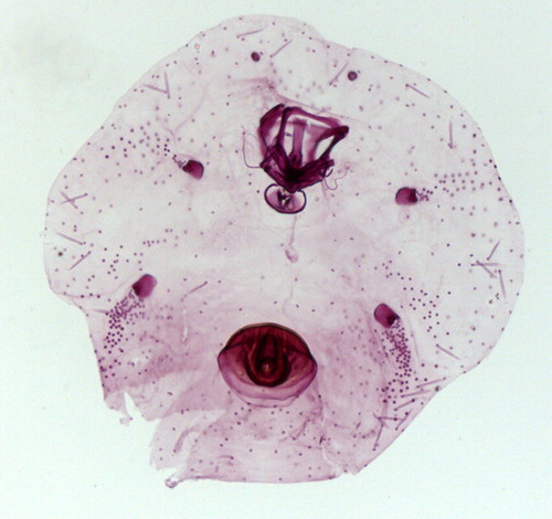 Figure 3 Slide-mounted adult female of Forticauda borchsenii n. gen., n. sp.
