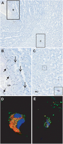 Figure 2.  IL-33 protein expression in the umbilical cord of normal term pregnancies. (A) IL-33 is expressed in the umbilical artery (B) and Wharton’s jelly (C). ×100 magnification. (B) IL-33 is expressed in the nuclei of endothelial (short arrows) and smooth muscle cells (arrows) in the umbilical vessels. ×200 magnification. (C) IL-33 is expressed in the nuclei of stromal cells in the Wharton’s jelly (inset). ×100 magnification. (D) Immunofluorescence staining of procollagen (red), IL-33 (green), and DAPI (blue) shows cytoplasmic IL-33 staining in myofibroblasts in the Wharton’s jelly. ×630 magnification. (E) Immunofluorescence staining of CD14 (red), IL-33 (green), and DAPI (blue) shows cytoplasmic IL-33 staining in macrophages in the Wharton’s jelly. ×630 magnification. UA = umbilical artery; WJ = Wharton’s jelly.