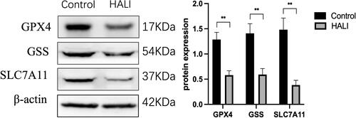 Figure 4 Western blotting analyzed the expression of GPX4, GSS, SLC7A11, which is ferroptosis key protein. **P < 0.01 vs the control group. Data were shown as mean ± SD, n = 3.