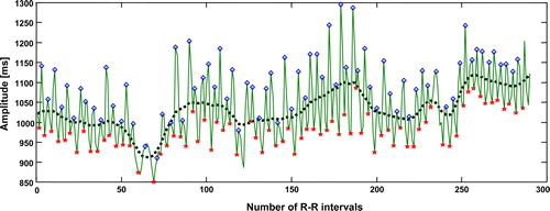 Figure 1.  Example of the R-R interval episode illustrating the variation around the adaptive threshold (dotted line). The minimums (star) and maximums (diamond) of the local R-R intervals are marked.