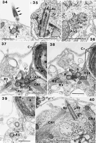 Figs 34–40. Flagellar root structure in Ochrosphaera neapolitana. Fig. 34. Tangential section of a flagellum showing the probable presence of the helical band at the base of the axoneme (arrow). Roots (R3, R4) are also visible in transverse section (arrowheads). Fig. 35. Longitudinal section of a flagellar base at the level of the axosome (Ax). Fig. 36. Transverse section of left and right flagellar bases (L and R) and haptonematal base (H) with five microtubules. Proximal and intermediary (Pb and Ib) striated bands connect the flagellar bases, and the accessory band links the haptonematal base and the left flagellar base (Ab3). Figs 37–39. Serial sections of the flagellar bases in transverse section: Fig. 37. Section through root (R1) showing linkage via accessory band (Ab4) to the left flagellar base. The crystalline component (CR1) is visible. Roots (R3, R4) extend from either side of the right flagellar base. The contractile root (Cr) extends along the surface of the chloroplast at the periphery of the cell; the connection of the Cr with the fibrous root (Fr) emanating from the left flagellar base is visible. Fig. 38. Section at the level of the Db. Accessory band (Ab4) is present. Fig. 39. Section through one of the flagella at the level of the axosome (Ax). Fig. 40. Section of roots (R1, R2) and their crystalline components (CR1, CR2). Scale bars represent 0.5 µm.