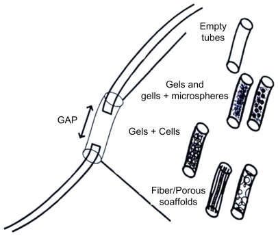 Figure 2 Tubes or guide types for peripheral nervous system regeneration.