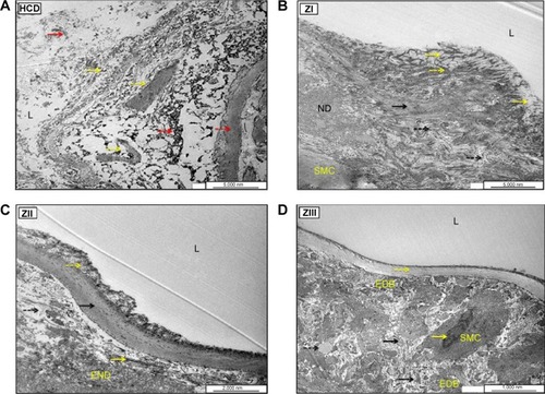 Figure 30 Ultrastructural electron micrographs of aortic endothelial cells (ECs) in HCD (A), ZI (B), ZII (C), and ZIII (D) groups.