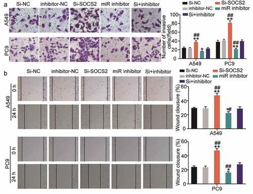 Figure 6. miR-3648 reverse the suppression effects of SOCS2 on LUAD cell metastasis A. Cell invasion was evaluated via transwell assay in A549 and PC9 cells after transfection with miR-3648 inhibitor, si-SOCS2, si-NC, inhibitor-NC and co-transfection with miR-3648 inhibitor and si-SOCS2. B. Cell migration was examined in PC9 and A549 cell lines after transfection with miR-3648 inhibitor, si-SOCS2, si-NC, inhibitor-NC and co-transfection with miR-3648 inhibitor and si-SOCS2 via wound healing assay. *P < 0.05, **P < 0.001 compared with si-NC group; #P < 0.05, ##P < 0.001 compared with si+inhibitor group, Student’s t-test.