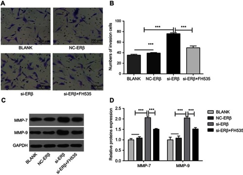 Figure 5 The invasion of U2-OS cells detected by Transwell assay and Western blot. (A) Invasion cells under a microscope (bar =200 μm, ×20); (B) the number of invasion cells; (C) protein brands of Western blot; (D) relative expression of MMP-7 and MMP-9 at protein level (Western blot). si-ERβ, U2-OS cells transfected with siRNA-ERβ for 48 hrs; NC-ERβ, U2-OS cells transfected with siRNA-negative control-ERβ for 48 hrs; si-ERβ + FH535, U2-OS cells transfected with siRNA-ERβ and treated with 20 μmol/L FH535 for 48 hrs; blank, U2-OS cells without transfection and treatment. ***P<0.001.Abbreviations: ERβ, estrogen receptor β; OS, ostemsarcoma; GAPDH, glyceraldehyde-3-phosphate dehydrogenase; MMP, matrix metalloproteinase; NC, negative control; si, small interfering RNA.