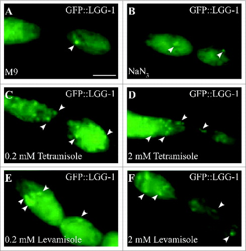 Figure 7. GFP::LGG-1 pattern in L3 larva using different mounting methods. (A) GFP::LGG-1 is largely diffuse in seam cells of L3 larvae mounted with M9 medium on a 2% agarose pad. These animals are not paralyzed. (B) GFP::LGG-1 is largely diffuse in seam cells of fully anesthetized L3 larvae mounted in a final concentration of 0.1 % (w/v; ∼150 mM) NaN3 in M9 medium on a 2% agarose pad with the same concentration of NaN3. (C–D) GFP::LGG-1 forms many different-sized punctate structures (arrows) in the seam cells (and other tissues) of fully anesthetized L3 larvae mounted in a final concentration of 0.2 mM (C), or 2 mM (D) tetramisole in M9 medium on a 2% agarose pad. Punctate structures start appearing 5 min after mounting. (E–F) GFP::LGG-1 forms many different-sized punctate structures (arrows) in the seam cells (and other tissues) of fully anesthetized LC3 larvae mounted in a final concentration of 0.2 mM (C) or 2 mM (D) levamisole in M9 medium on a 2% agarose pad. Punctate structures start appearing 5 min after mounting. Scale bar: 5 μm.