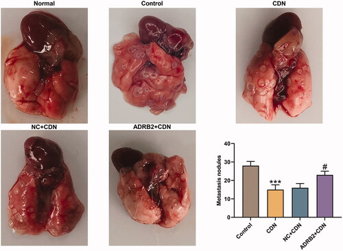 Figure 7. ADRB2 overexpression reversed the inhibitory effect of CDN on metastatic lung nodules in CRC metastasis model. (A) In the presence of pulmonary metastatic nodules in nude mice 5 weeks after tail vein injection of the tumour cells, the number of metastatic nodules in the lung was counted. ***p < 0.001 vs. control; #p < 0.05 vs. NC + CDN. CDN: cardamonin; CRC: colorectal cancer.