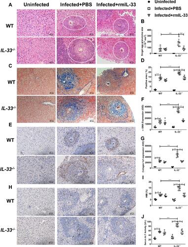 Figure 2 IL-33 deficiency aggravated liver pathological lesions in murine schistosomiasis japonica. WT and IL-33−/− mice were divided into uninfected group, infected plus rmIL-33 group and infected plus PBS group. Each mouse in the infected groups was infected with 20 cercariae through shaved abdominal skin. Mice in the infected plus rmIL-33 group were intraperitoneally injected with exogenous rmIL-33 (dissolved in sterile PBS solution) from the 4th week to 8th week post infection, with the total 5 μg of rmIL-33 per mouse. The mice in the infection plus PBS group were simultaneously given the equal volume of PBS. The liver weight and body weight of all mice were recorded. At the 8th week post infection, all mice were sacrificed and the liver and peripheral blood were collected. (A) Representative images of HE staining of liver sections (single egg granuloma indicated by white circles) and (B) the statistical graphs of single granuloma area. (C) Representative images of Masson’s staining of liver sections and (D) the statistical graphs of the blue collagen area proportion. The hepatic expression of two main extracellular matrix components, α-SMA (E) and Collagen 1a1 (H). The statistics of IOD of α-SMA (F) and Collagen 1a1 (G). The statistical graphs of HMI (Hepatic Mass Index, (I)) and ALT (Alanine aminotransferase, (J)) levels in peripheral blood from mice. Data are expressed as means ± SEMs based on 6 mice in each group and from 2 independent experiments. Asterisks mark significant differences among different groups (**P < 0.01, ***P < 0.001).