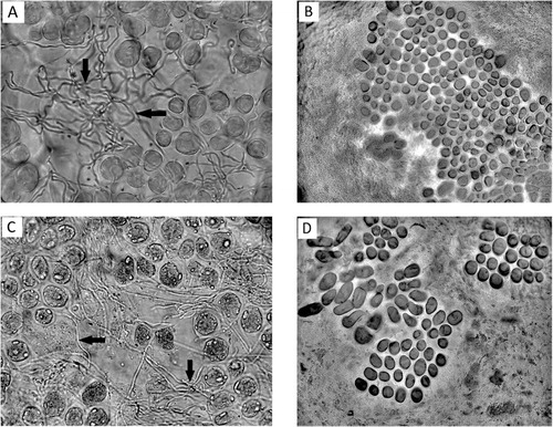 Figure 1 Microscopic observation of seeds of diploid cultivars (A, B) and tetraploid cultivars (C, D) of Lolium multiflorum Lam. Presence of the hyphae (arrows) of endophyte between aleurone cells from the endosperm (A, C), and their absence (B, D). Magnification: 400×.