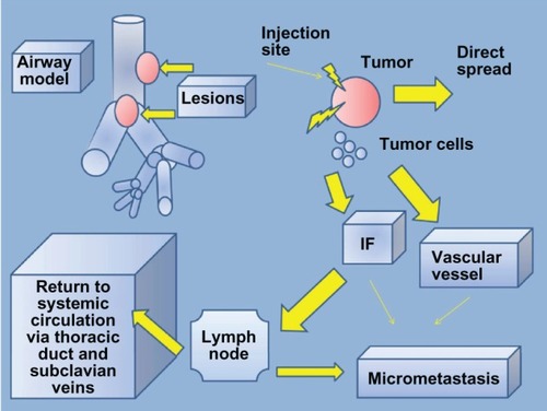 Figure 5 Intratumoral chemotherapy model.