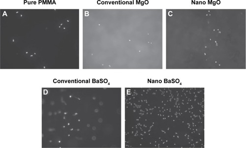 Figure 2 Fluorescent images showing osteoblast adhesion (nuclei stained with DAPI) on PMMA modified with nano and conventional MgO and BaSO4 (magnification 100×). (A) Pure PMMA; (B) conventional MgO; (C) nano MgO; (D) conventional BaSO4; and (E) nano BaSO4.Notes: Osteoblast adhesion was significantly increased on nanoparticle-modified PMMA compared with pure PMMA or PMMA modified with conventional particles. Copyright ©2008. Dove Medical Press. Reproduced from Ricker A, Liu-Snyder P, Webster TJ. The influence of nano MgO and BaSO4 particle size additives on properties of PMMA bone cement. Int J Nanomedicine. 2008;3:125–132.Citation43Abbreviations: PMMA, polymethylacrylate; DAPI, 4,6-diamidino-2-phenylindole.