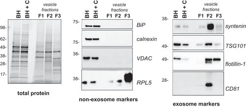 Figure 3. Western blot analysis of frontal cortex and associated vesicles. Equivalent protein from human frontal cortex brain homogenate without (BH) and with collagenase (BH + C) and three vesicle fractions were separated by gel electrophoresis and the total protein load was visualized using stain-free technology or ponceau S membrane staining. Immunoblotting was carried out using antibodies to BiP, calnexin, calreticulin, VDAC,, flotillin-1, syntenin, TSG101 and CD81. Immunoblots are representative of at least five independent experiments.