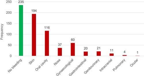 Figure 2 Bleeding symptoms at presentation by anatomical site.