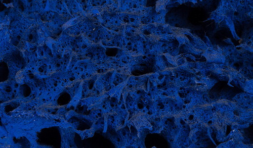 Figure 11. Macro image of a portion of the sponge in the Museum of Modern Art before cleaning. Note the presence of dark particles on the surface.