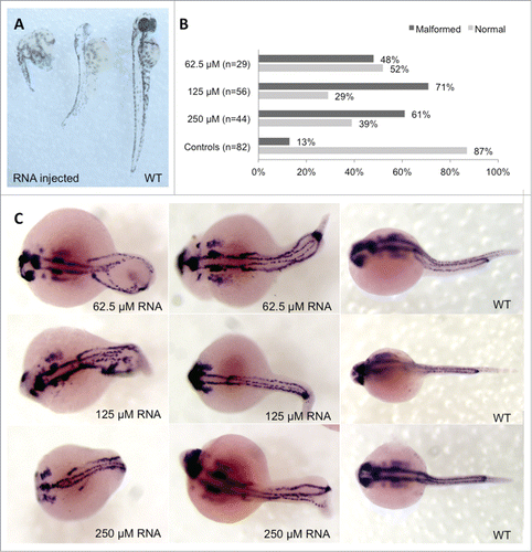 Figure 3. Phenotype analysis of Hoxb7a-overexpression in zebrafish embryos. (A) Phenotype analysis at 72 hpf of Hoxb7a mRNA injected zebrafish resulted in significant hypopigmentation and malformation in 66% of the injected zebrafish. These embryos had shorter anterior/posterior axes as well as crooked or bent tails. (B) Phenotype analysis after pax2a staining at 24 hpf resulted in about 63% embryos with a mild or severe affected phenotype after Hoxb7a overexpression compared to 13% in injected controls. (C) Pax2a staining after microinjection of different concentrations of mRNA. From left to right severe, mild affected and wild type (WT) embryos at 24 hpf. WT zebrafish show expression in the hindbrain, hindbrain-midbrain boundary, neural tube, mesoderm, optic stalk, otic vesicle, and pronephric duct. Microinjection 62.5 μM mRNA, 125 μM mRNA and 250 μM mRNA resulted in respectively 48%, 71% and 61% malformed zebrafish. There was no correlation between mRNA dosage and severity of malformation.