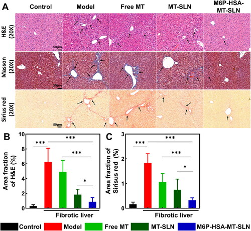 Figure 6. The progression of CCl4-induced liver fibrosis was significantly suppressed by M6P-HSA-MT-SLN. (A) Representative images of H&E, Masson and Sirius red-stained liver sections; scale bars are 50 μm. (B) H&E and Sirius red staining quantitative analysis of liver sections. Data represented as mean ± SD, n = 6; *p < 0.05, **p < 0.01, ***p < 0.001.