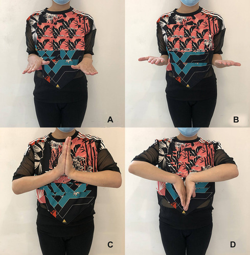 Figure 3 Follow-up after 3 months of surgery of the patient. The pronation and supination of forearm (A and B). The flexion and extension functions of wrist (C and D).