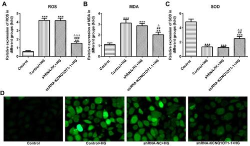 Figure 3 KCNQ1OT1 interference alleviated the oxidative stress in HG-induced HK-2 cells. (A) ROS level was increased in HG-induced HK-2 cells and KCNQ1OT1 expression was decreased in HG-induced HK-2 cells transfected with shRNA-KCNQ1OT1-1. **P<0.01 and ***P<0.001 vs. control group. ###P<0.001 vs. control+HG group. ∆∆∆P<0.001 vs. shRNA-NC+HG group. (B) MDA level was increased in HG-induced HK-2 cells and KCNQ1OT1 expression was decreased in HG-induced HK-2 cells transfected with shRNA-KCNQ1OT1-1. **P<0.01 and ***P<0.001 vs. control group. ##P<0.01 vs. control+HG group. ∆P<0.05 vs. shRNA-NC+HG group. (C) SOD level was decreased in HG-induced HK-2 cells and KCNQ1OT1 expression was increased in HG-induced HK-2 cells transfected with shRNA-KCNQ1OT1-1. ***P<0.001 vs. control group. ##P<0.01 vs. control+HG group. ∆∆P<0.01 vs. shRNA-NC+HG group. (D) ROS level was verified by the images of immunofluorescence. (n=3).