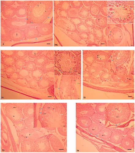 Figure 3. Effect of royal jelly on taxol-induced histopathological changes in the seminiferous tubules. C: control;TXL: taxol-received animals; T1, T2, T3: the TXL-treated animals which received various dose levels of RJ; T4: received RJ only; spermatozoids (black arrow), cytoplasmic residues (black arrow head), spermatids (white arrow), spermatocyte I (white arrow head), spermatogonium (blue arrow), Sertoli cell (blue arrow head), tunica albuginea (yellow arrow), pyknotic spermatocyte I (yellow arrow head), cell shrinkage (green arrow), ring from condensation of chromatin around the nuclear periphery of spermatids (green arrow head), multinucleated giant cells (red arrow), and depletion areas (red arrow head). Hematoxylin and eosin staining; original magnification -100 X and scale bars = 100 µm, and high magnification 200 X and scale bars = 25 µm.