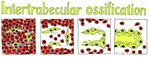 Figure 2. A drawing of the main bone-forming process in inter-trabecular bone formation; condensations of mesenchymal cells forming osteoid, which becomes woven bone.