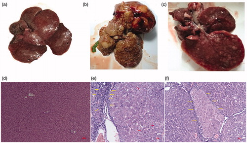 Figure 1. Photographs of the livers of healthy (a), DEN-induced HCC rat (b) and HCC rat administered 1,4-GL (c); Hepatic pathological changes (HE ×100) in healthy rat (d), DEN-induced HCC rat (e), and HCC rat administered 1,4-GL (f).